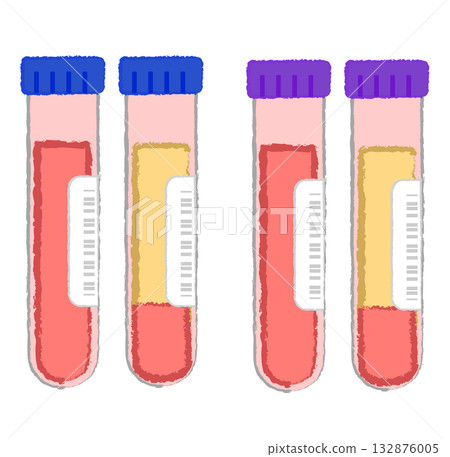 Blood test - test tube with blood sample 132876005