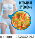 Intestinal dysbiosis is an imbalance of the gut microbiota between harmful and beneficial bacteria 132882198