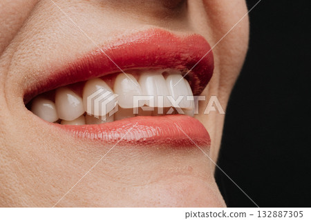 Closeup smile with white porcelain veneers and coral lipstick dental aesthetic beauty 132887305
