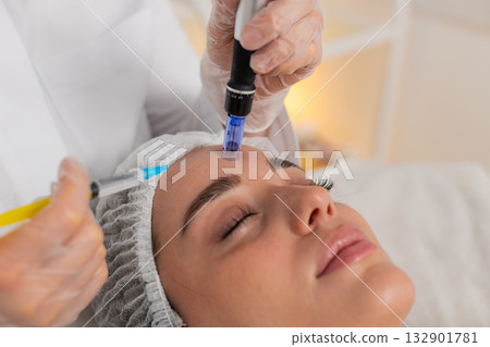 Cosmetologist doing peeling procedure, woman skin regeneration, dermapen microneedling, dermastamp Cosmetologist doing peeling procedure, woman skin regeneration, dermapen microneedling, dermastamp 132901781