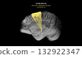 Parkinson Dopamine Loss Hyperdirect Pathway Disruption Sagittal View 132922347