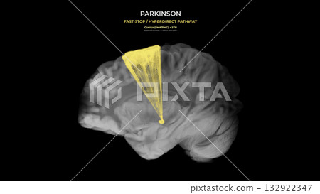 Parkinson Dopamine Loss Hyperdirect Pathway Disruption Sagittal View Parkinson Dopamine Loss Hyperdirect Pathway Disruption Sagittal View 132922347