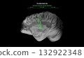 Parkinson Dopamine Loss Thalamo Motor Cortex Pathway Disruption Sagittal View 132922348