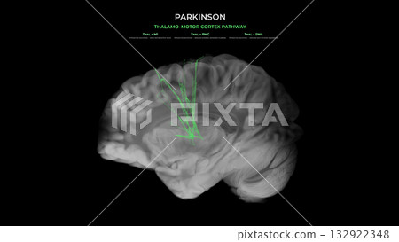 Parkinson Dopamine Loss Thalamo Motor Cortex Pathway Disruption Sagittal View Parkinson Dopamine Loss Thalamo Motor Cortex Pathway Disruption Sagittal View 132922348