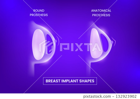 3D poster comparing round and anatomical silicone breast implants, neon purple background. 132923902