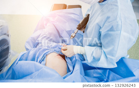 Arthroscope surgery. Orthopedic surgeons in teamwork in the operating room 132926243