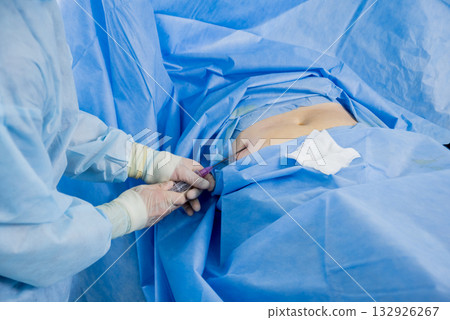 Arthroscope surgery. Orthopedic surgeons in teamwork in the operating room 132926267