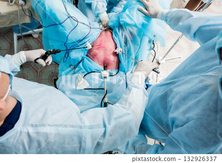Process of gynecological surgery operation using laparoscopic equipment. Process of gynecological surgery operation using laparoscopic equipment. 132926337