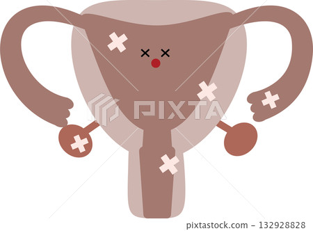 患病子宮的插圖 132928828