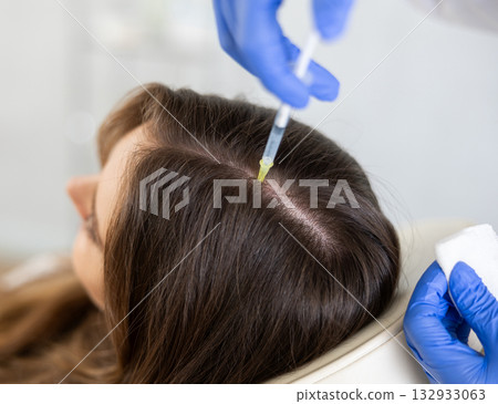 Young woman having hair care by means of injection in aesthetic clinic Young woman having hair care by means of injection in aesthetic clinic 132933063