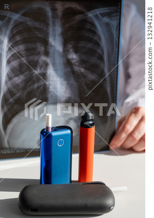 Doctor holds x-ray of lungs with e-cigarettes and vape in background. Doctor holds x-ray of lungs with e-cigarettes and vape in background. 132941218