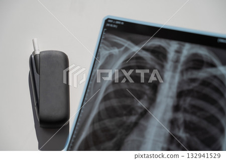 Electronic cigarette and lung x-ray. Tobacco heating system.  132941529