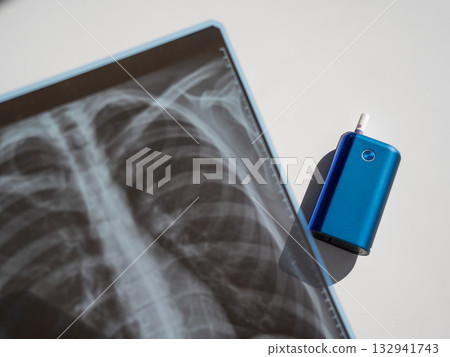 Electronic cigarette and lung x-ray. Tobacco heating system. Electronic cigarette and lung x-ray. Tobacco heating system. 132941743