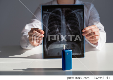 Doctor holding x-ray of lungs with e-cigarette in background.  132941917