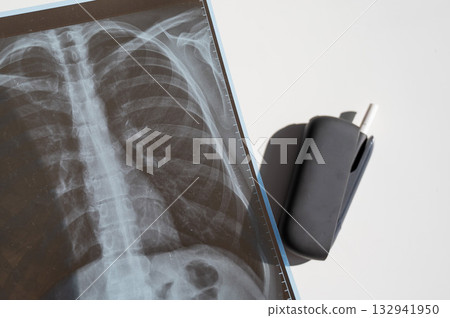 Electronic cigarette and lung x-ray. Tobacco heating system. Electronic cigarette and lung x-ray. Tobacco heating system. 132941950