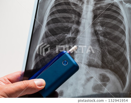 Electronic cigarette and lung x-ray. Tobacco heating system. Electronic cigarette and lung x-ray. Tobacco heating system. 132941954