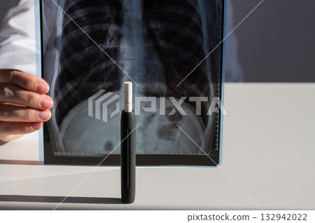 Doctor holding x-ray of lungs with e-cigarette in background. Doctor holding x-ray of lungs with e-cigarette in background. 132942022