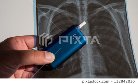 Electronic cigarette and lung x-ray. Tobacco heating system.  132942030