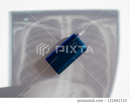 Electronic cigarette and lung x-ray. Tobacco heating system. Electronic cigarette and lung x-ray. Tobacco heating system. 132942135