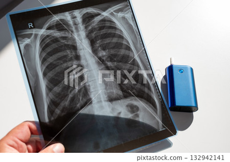 Electronic cigarette and lung x-ray. Tobacco heating system.  132942141