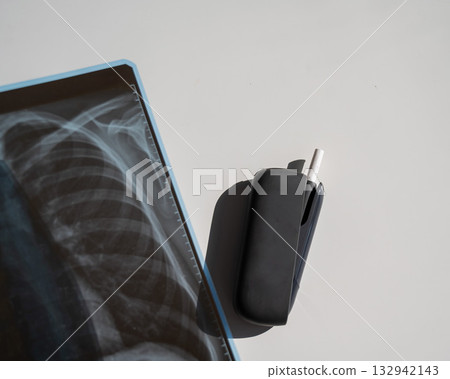 Electronic cigarette and lung x-ray. Tobacco heating system.  132942143