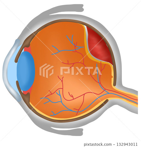 Ocular Tumor or Eye Cancer, Malignant Growth in Eye Anatomy 132943011