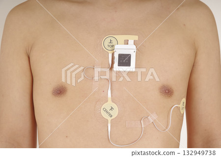 Chest of a middle-aged man wearing an electrocardiogram Holter monitor 132949738