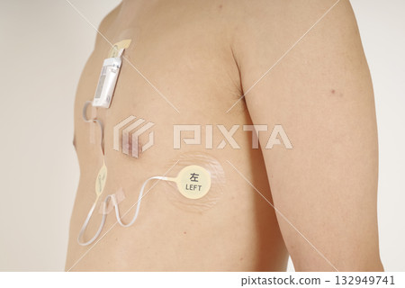 一位配戴心電圖動態心電圖監測儀的中年男子的胸部照片 132949741