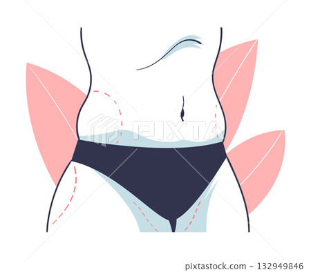 Plastic Surgery with Fat on Belly Correction in Aesthetic Beauty Clinic Vector Illustration 132949846