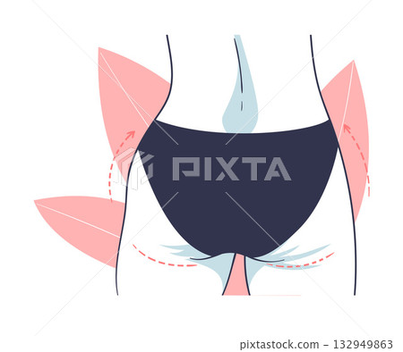 Plastic Surgery with Buttocks Body Part Correction in Aesthetic Beauty Clinic Vector Illustration Plastic Surgery with Buttocks Body Part Correction in Aesthetic Beauty Clinic Vector Illustration 132949863