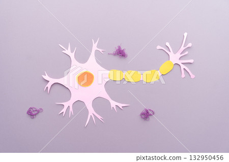 Alzheimer's disease brain. Nerve cell in neurodegenerative disease with amyloid plaques made from paper on violet background. 132950456