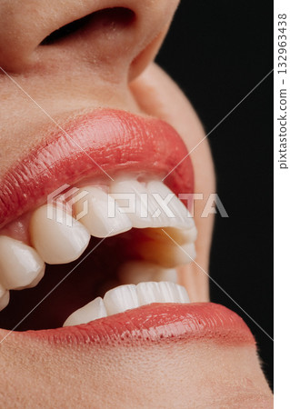 Macro closeup of perfect white porcelain veneers with glossy coral lipstick smile Macro closeup of perfect white porcelain veneers with glossy coral lipstick smile 132963438