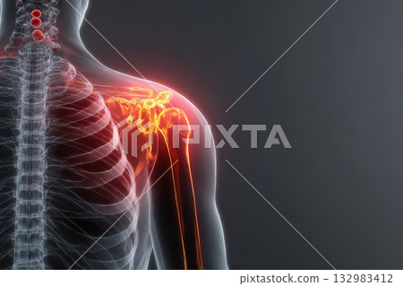 Human figure with shoulder joint ache X-ray illustration human anatomy. Back, neck lumbar pain relief techniques, spinal health in daily life. Red orange back pain sign digital overlay. Inflammation 132983412