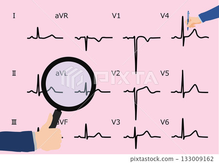 Graphic illustration of interpreting an electrocardiogram Graphic illustration of interpreting an electrocardiogram 133009162