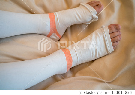 be hospitalized, feet, paw 133011856