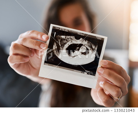 Hands, sonogram photo and closeup for woman, pregnancy and baby for health, wellness and growth. Ultrasound picture, fetus or infant development for healthcare, progress and monitor for unborn child 133021043