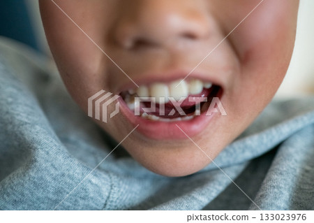 younger, tooth, baby boy 133023976