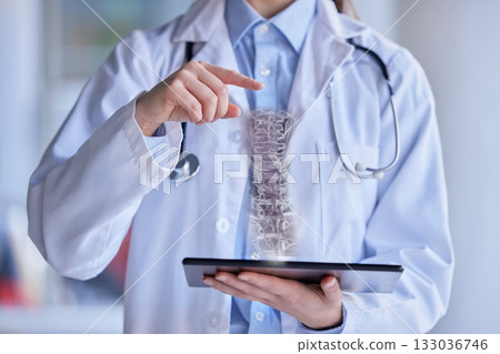 Spine skeleton hologram, doctor and hands with tablet, 3D and futuristic, digital transformation and woman in clinic..Metaverse, future technology in orthopedic healthcare and innovation with anatomy Spine skeleton hologram, doctor and hands with tablet, 3D and futuristic, digital transformation and woman in clinic..Metaverse, future technology in orthopedic healthcare and innovation with anatomy 133036746