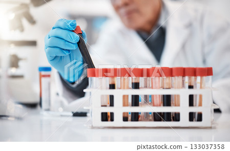 Blood, test tube and hands of scientist in laboratory with sample for research, medical study and science. Healthcare, pharmaceutical and old man with vial for dna testing, biology and rna analysis 133037358