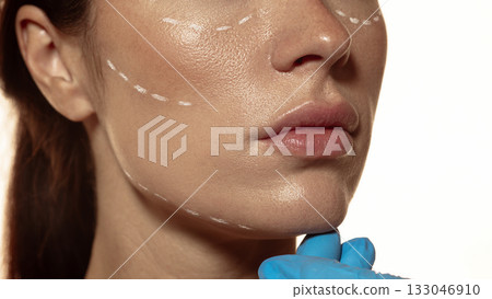 Closeup of lower face during aesthetic consultation with white facial markings Closeup of lower face during aesthetic consultation with white facial markings 133046910