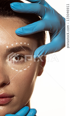 Facial marking lines around eyes before cosmetic rejuvenation treatment. 133046911