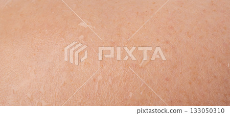 Wet human skin with water drops closeup. Sweat healthy body, macro shower drops on woman skin 133050310