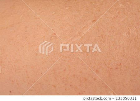 Wet human skin with water drops closeup. Sweat healthy body, macro shower drops on woman skin 133050311