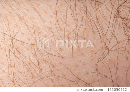 Wet human skin with water drops closeup. Sweat healthy body, macro shower drops on woman skin 133050312