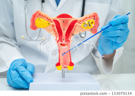 Doctor holding human uterus model for vaginal and cervix pap smear check up in the obstetrics and gynecology. 133079134