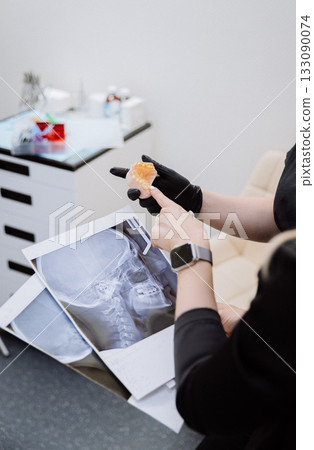 Orthodontic consultation with cephalometric X rays and jaw model, modern dental clinic 133090074