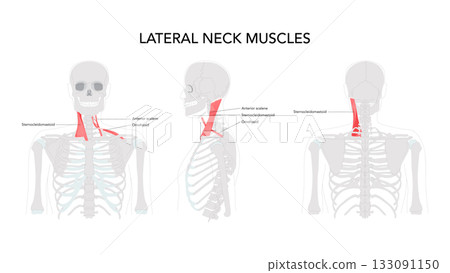 Lateral Neck Muscles - Group of muscles located on the sides of the neck, including the anterior, middle, and posterio 133091150
