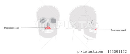 Depressor septi - Nasal muscle lowering nasal septum and opening nostrils, shown in precise labeled diagram important Depressor septi - Nasal muscle lowering nasal septum and opening nostrils, shown in precise labeled diagram important 133091152