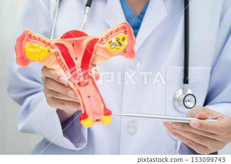 Uterus, doctor holding human anatomy model for study diagnosis and treatment in hospital. 133099743