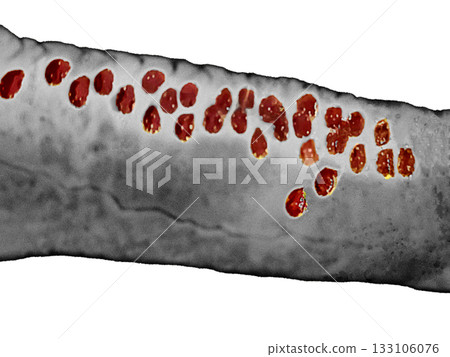 Zombie arm transparent PNG, grotesque and creepy illustration in blood-red tones - Fruit Inspired Zombie arm transparent PNG, grotesque and creepy illustration in blood-red tones - Fruit Inspired 133106076